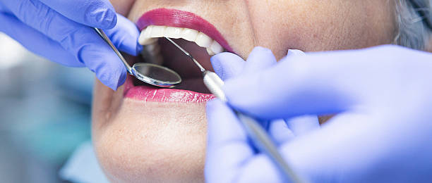 Best Walk-In Emergency Dentist in Banner Elk, NC